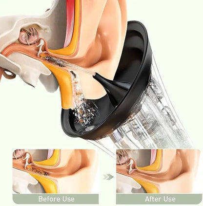 Electric Earwax Removal Kit with IPX6 Water Resistance